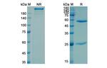 Campath-9H Humanized Recombinant Human Monoclonal Antibody