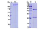 Edrecolomab Antibody in SDS-PAGE (SDS-PAGE)