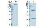 Enlimomab Antibody in SDS-PAGE (SDS-PAGE)