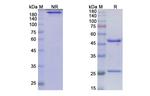 Immurait-Ll2Mab Antibody in SDS-PAGE (SDS-PAGE)