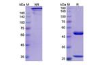 CD25 (Inolimomab Biosimilar) Antibody in SDS-PAGE (SDS-PAGE)