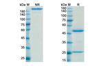 Muromonab Recombinant Mouse Monoclonal Antibody