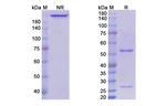 Nofetumomab Recombinant Mouse Monoclonal Antibody