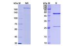 Milatuzumab Humanized Antibody in SDS-PAGE (SDS-PAGE)