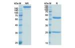 Oregovomab Antibody in SDS-PAGE (SDS-PAGE)