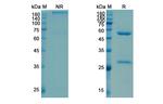 Satumomab Recombinant Mouse Monoclonal Antibody