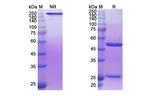 Derlotuximab Chimeric Recombinant Human Monoclonal Antibody