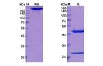 cT84.66 Chimeric Antibody in SDS-PAGE (SDS-PAGE)