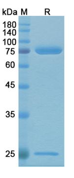 Alg-991 Chimeric Recombinant Human Monoclonal Antibody
