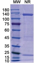 Basiliximab Chimeric Antibody in SDS-PAGE (SDS-PAGE)