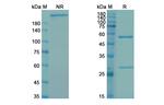 Bavituximab Chimeric Recombinant Human Monoclonal Antibody