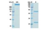 Galiximab Chimeric Antibody in SDS-PAGE (SDS-PAGE)