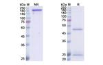 ICM3 Antibody in SDS-PAGE (SDS-PAGE)