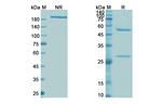 Infliximab Chimeric Antibody in SDS-PAGE (SDS-PAGE)