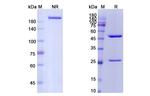Keliximab Chimeric Recombinant Human Monoclonal Antibody