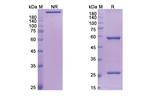 CD23 (Lumiliximab Biosimilar) Recombinant Human Monoclonal Antibody