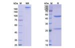 HLA-DRB1 (Oncolym Biosimilar) Recombinant Mouse Monoclonal Antibody