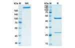 Priliximab Chimeric Recombinant Human Monoclonal Antibody