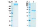 Rituximab Chimeric Recombinant Human Monoclonal Antibody