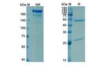 Briakinumab Antibody in SDS-PAGE (SDS-PAGE)