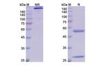 EpCAM (CD326) (Adecatumumab Biosimilar) Antibody in SDS-PAGE (SDS-PAGE)