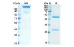 Adalimumab Antibody in SDS-PAGE (SDS-PAGE)
