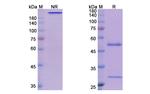 Mk-4721 Recombinant Human Monoclonal Antibody
