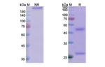 Tuvirumab Recombinant Human Monoclonal Antibody