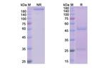 Tralokinumab Antibody in SDS-PAGE (SDS-PAGE)