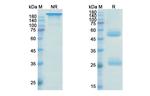 IL-12 p40 (Ustekinumab Biosimilar) Antibody in SDS-PAGE (SDS-PAGE)