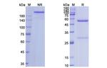 Fresolimumab Antibody in SDS-PAGE (SDS-PAGE)