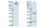 Golimumab Antibody in SDS-PAGE (SDS-PAGE)