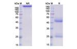 Humax-Il15 Antibody in SDS-PAGE (SDS-PAGE)
