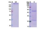 J695 Humanized Recombinant Human Monoclonal Antibody