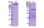 Mapatumumab Recombinant Human Monoclonal Antibody