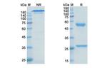 Metelimumab Antibody in SDS-PAGE (SDS-PAGE)