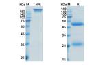 Otilimab Antibody in SDS-PAGE (SDS-PAGE)