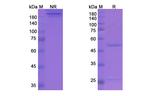 Stamulumab Recombinant Human Monoclonal Antibody