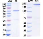 OST 577 Recombinant Human Monoclonal Antibody