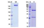 EGFR (Panitumumab Biosimilar) Antibody in SDS-PAGE (SDS-PAGE)