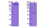Regavirumab Recombinant Human Monoclonal Antibody