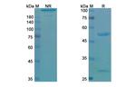 Votumumab Antibody in Western Blot (WB)