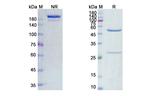 EGFR (Zalutumumab Biosimilar) Antibody in SDS-PAGE (SDS-PAGE)