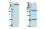 CD4 (Zanolimumab Biosimilar) Antibody in SDS-PAGE (SDS-PAGE)