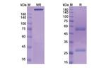 MUC1 (CMB-401 Biosimilar) Recombinant Human Monoclonal Antibody