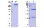 TNF alpha (CDP571 Biosimilar) Antibody in SDS-PAGE (SDS-PAGE)