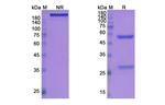 Gantenerumab Antibody in SDS-PAGE (SDS-PAGE)