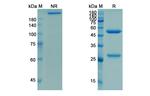 Racotumomab Recombinant Mouse Monoclonal Antibody