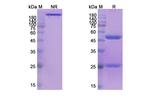 Tenatumomab Recombinant Mouse Monoclonal Antibody
