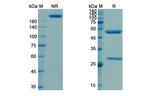 Camidanlumab Antibody in SDS-PAGE (SDS-PAGE)